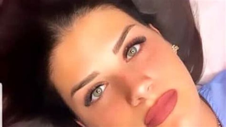 Alessia Neboso Dies After Breast Surgery