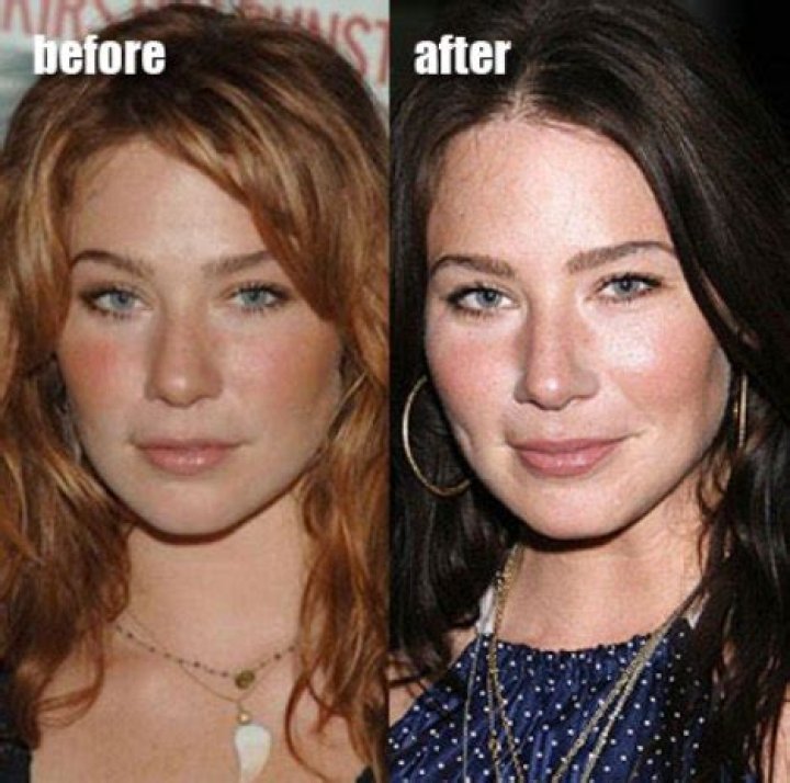 Lynn Collins Plastic Surgery Before and After